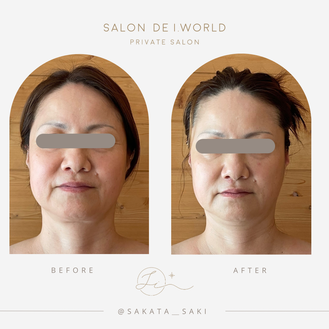 インディバビフォーアフター