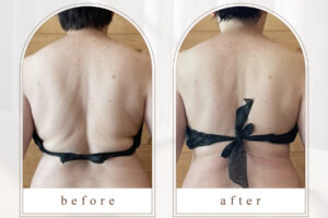 インディバ ビフォーアフター