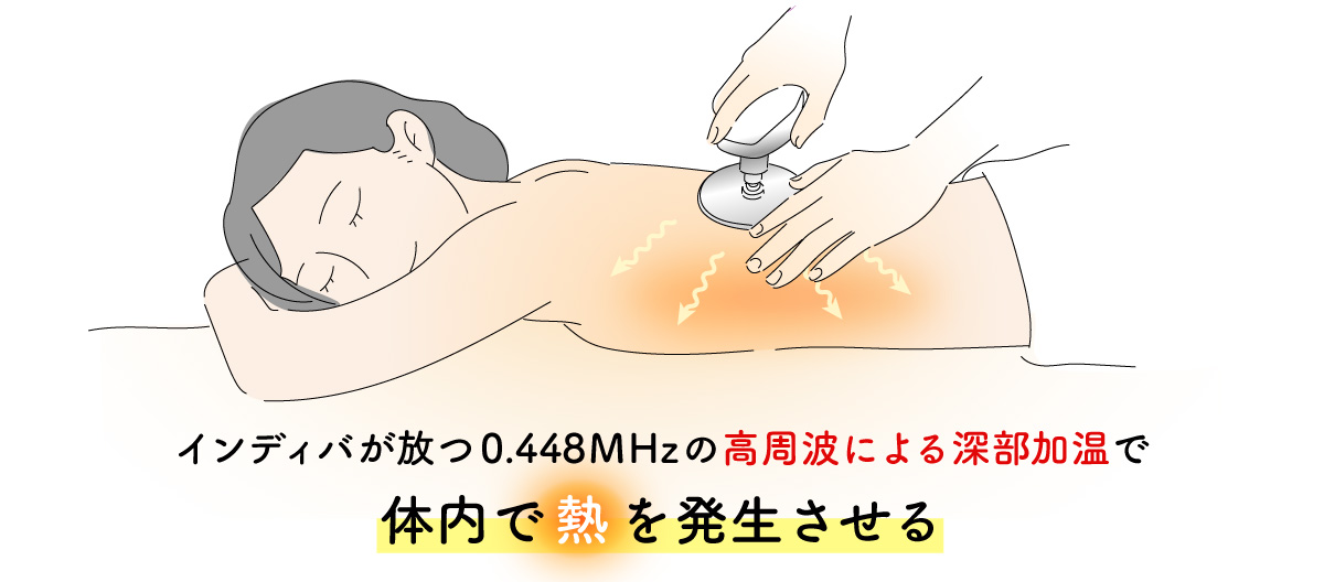 インディバの特徴