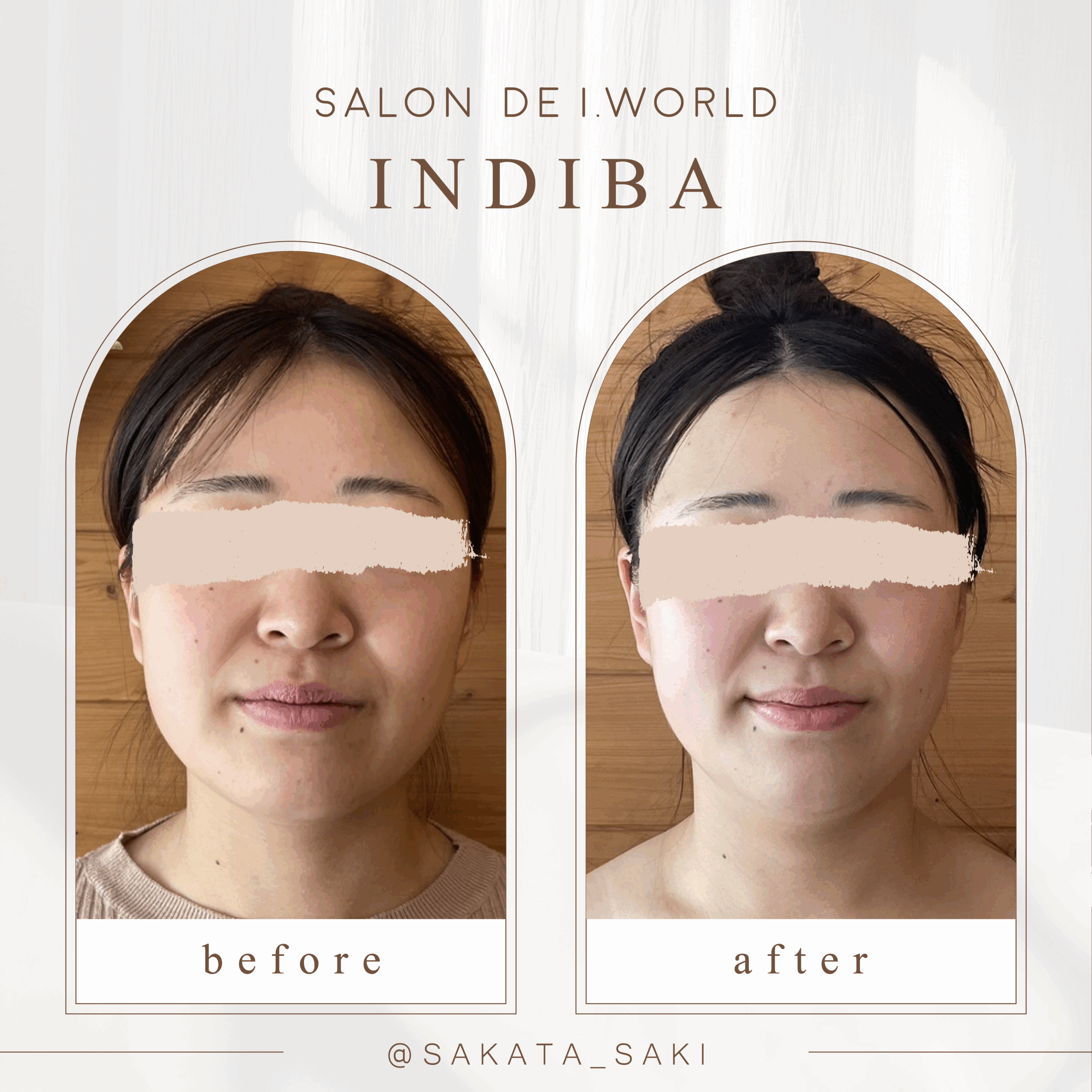 顔痩せビフォーアフター