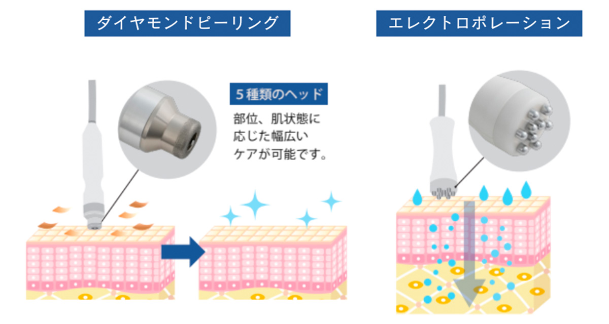 ダイヤモンドピーリングの仕組み