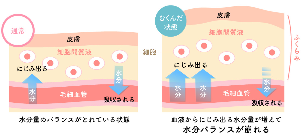 むくみの仕組み