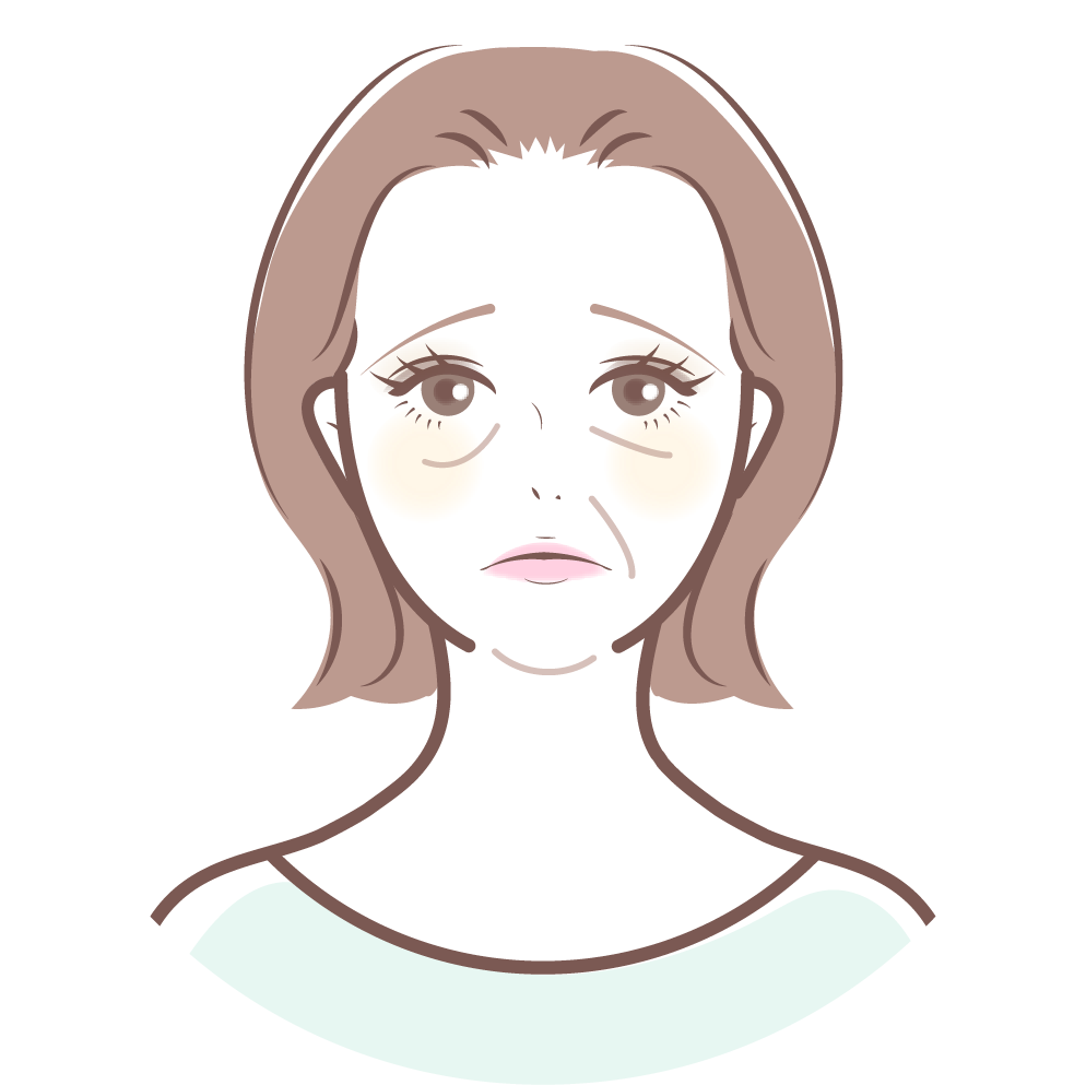 女性の顔がたるんでいるイラスト