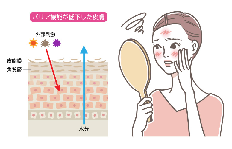 バリア機能の低下と「敏感肌」イラスト