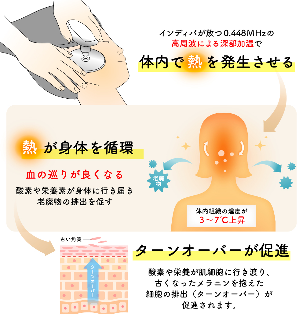 シミを根本から改善、インディバフェイシャルの効果
